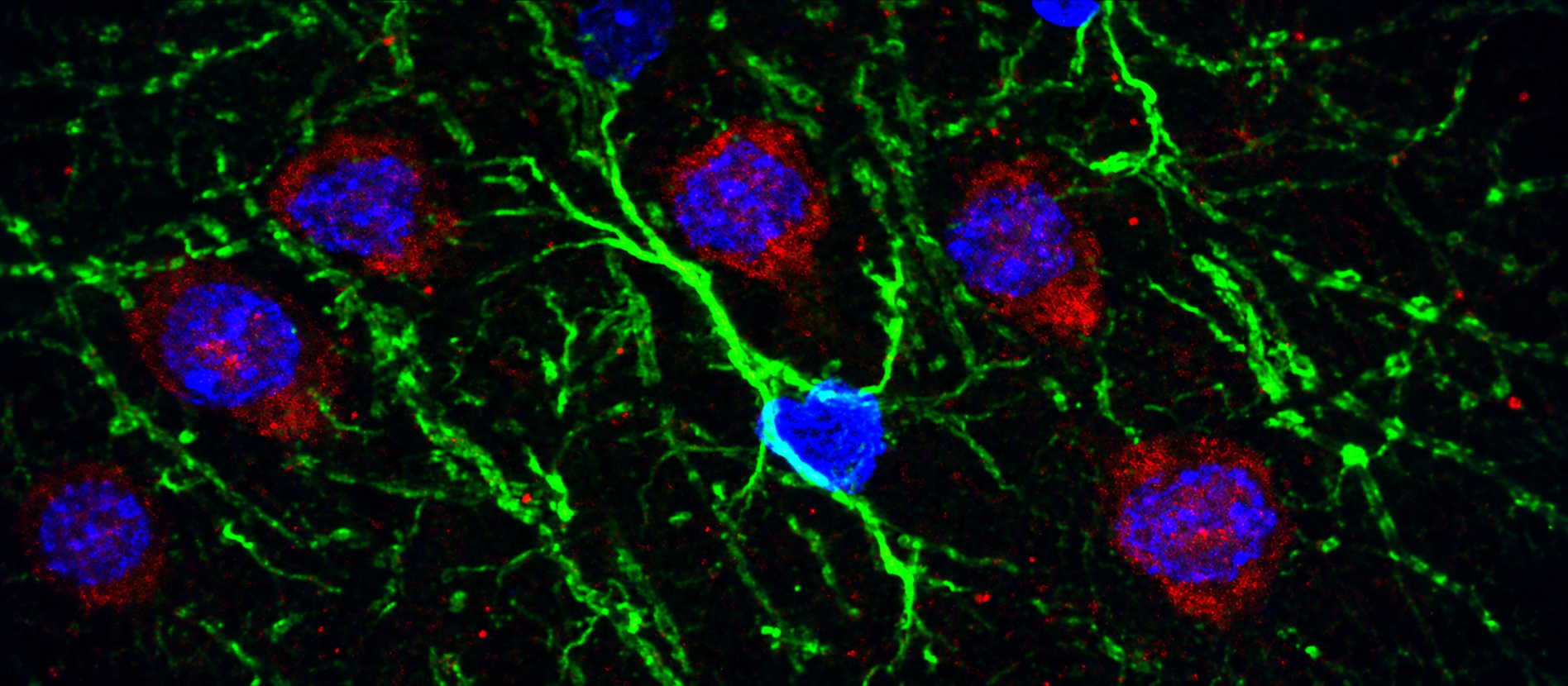 Confocal microscopy image from the Brain Gardening research archive